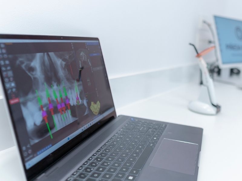 tecnologia-tac-3d-cbct-clinica-dental-en-alcobendas