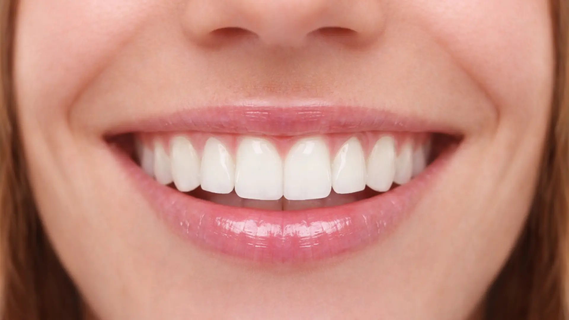 Blanqueamiento domiciliario