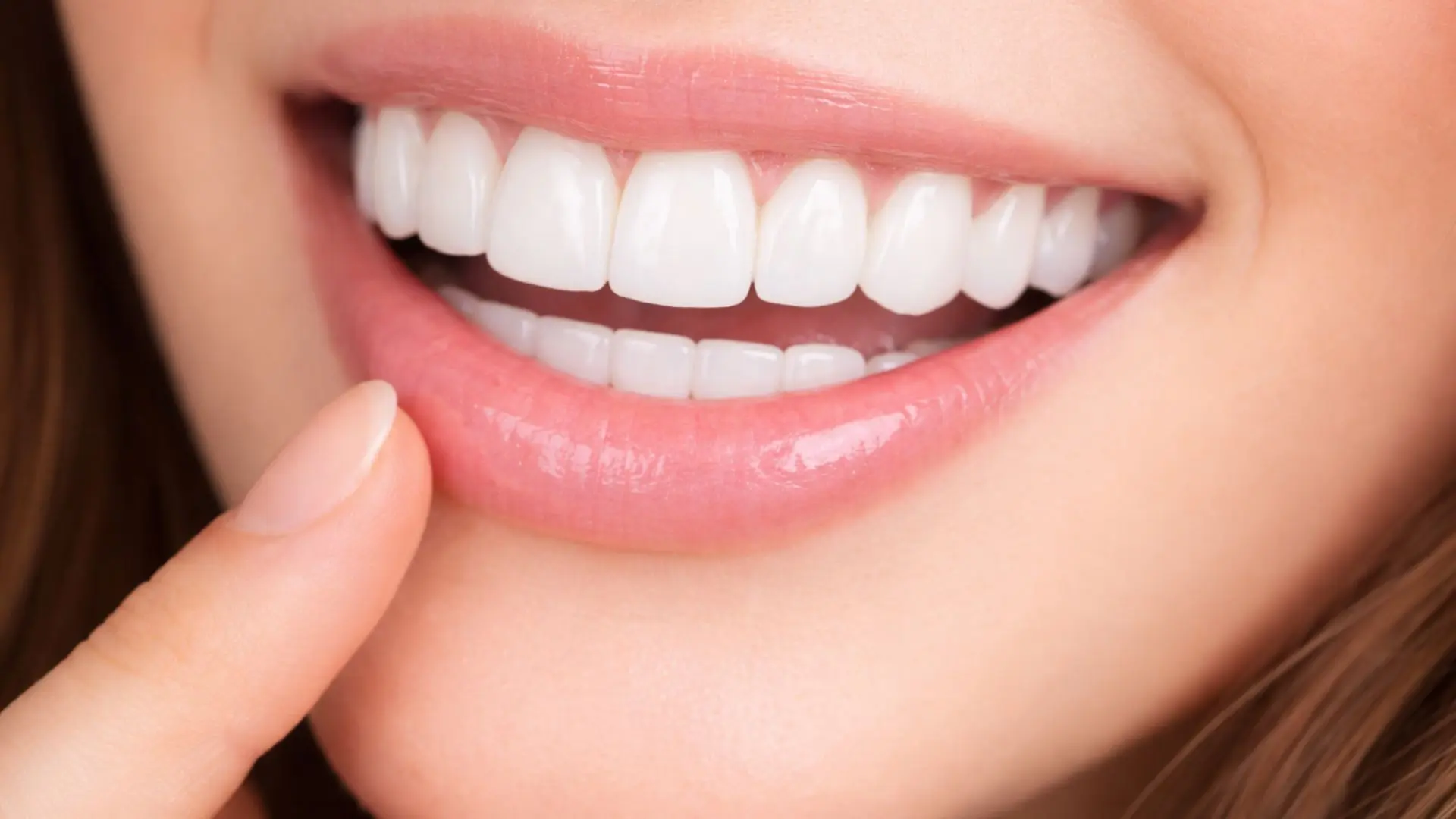 Carillas de porcelana en Pineda&Odeh