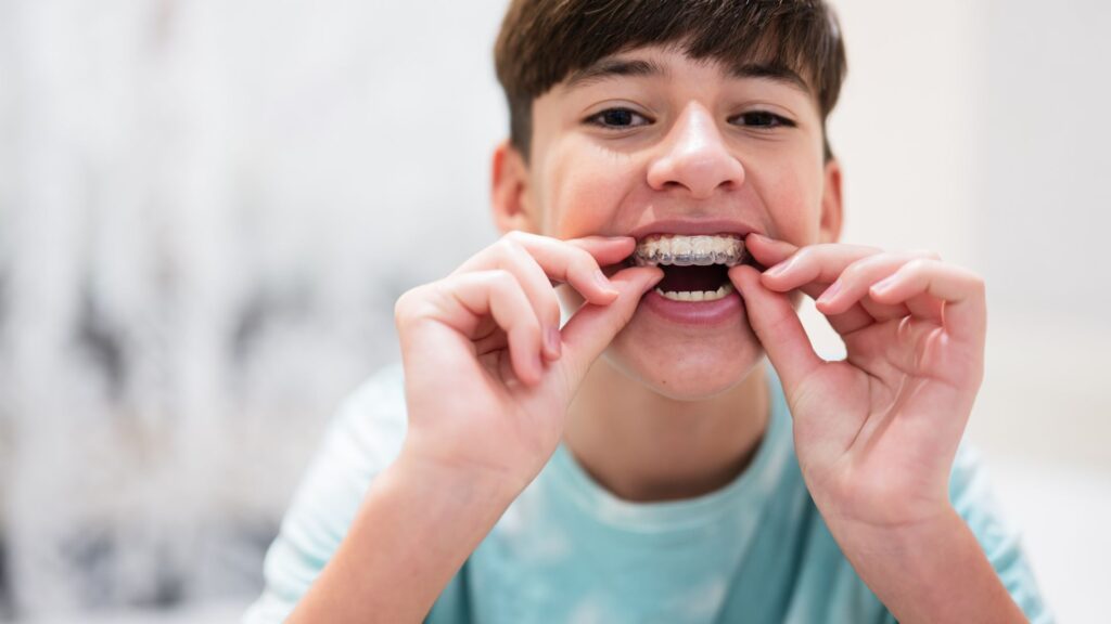 Ortodoncia invisible en Clinica Pienda&Odeh