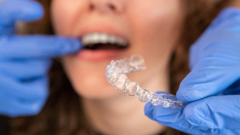 chica poniendose invisalign