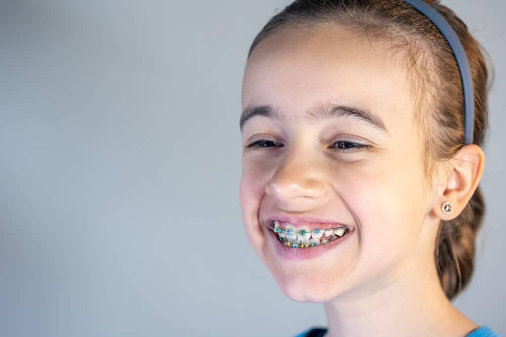 niña con ortodoncia infantil brackets